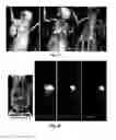Fig. 15 - Phospholipid analogs as diapeutic agents and methods thereof