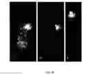Fig. 20 - Phospholipid analogs as diapeutic agents and methods thereof