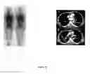 Fig. 23 - Phospholipid analogs as diapeutic agents and methods thereof