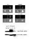 Fig. 02 - VIRAL VECTOR TARGETING CANCER STEM CELLS
