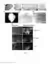 Fig. 02 - DECELLULARIZED LIVER TRANSPLANTATION COMPOSITION AND METHODS