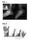 Fig. 05 - PHARMACEUTICAL COMPOSITION FOR TREATMENT AND PREVENTION OF TH3 MARCH-RELATED DISEASES