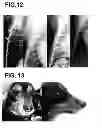 Fig. 09 - PHARMACEUTICAL COMPOSITION FOR TREATMENT AND PREVENTION OF TH3 MARCH-RELATED DISEASES