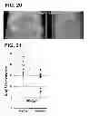 Fig. 13 - PHARMACEUTICAL COMPOSITION FOR TREATMENT AND PREVENTION OF TH3 MARCH-RELATED DISEASES