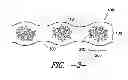 Fig. 03 - PROCESS FOR FORMING AN AGGLOMERATED PARTICLE CLOUD NETWORK COATED FIBER BUNDLE