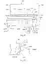 Fig. 10 - Battery device and electronic apparatus