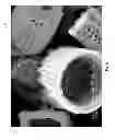 Fig. 04 - Diatomaceous energy storage devices