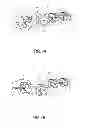 Fig. 09 - Orthodontic bracket