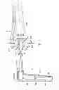 Fig. 02 - Electro-orthodontic device