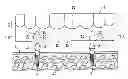 Fig. 01 - Denture system, engagement piece used for denture system, method for producing denture base and denture