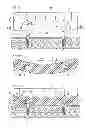 Fig. 02 - Denture system, engagement piece used for denture system, method for producing denture base and denture