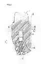 Fig. 03 - Denture system, engagement piece used for denture system, method for producing denture base and denture