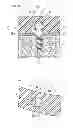 Fig. 04 - Denture system, engagement piece used for denture system, method for producing denture base and denture