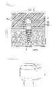 Fig. 05 - Denture system, engagement piece used for denture system, method for producing denture base and denture