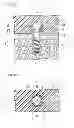 Fig. 06 - Denture system, engagement piece used for denture system, method for producing denture base and denture