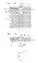 Fig. 08 - Denture system, engagement piece used for denture system, method for producing denture base and denture