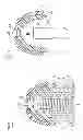 Fig. 22 - Denture system, engagement piece used for denture system, method for producing denture base and denture