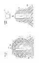 Fig. 23 - Denture system, engagement piece used for denture system, method for producing denture base and denture