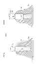 Fig. 24 - Denture system, engagement piece used for denture system, method for producing denture base and denture