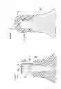 Fig. 25 - Denture system, engagement piece used for denture system, method for producing denture base and denture