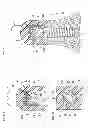 Fig. 28 - Denture system, engagement piece used for denture system, method for producing denture base and denture