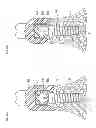 Fig. 29 - Denture system, engagement piece used for denture system, method for producing denture base and denture