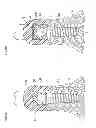 Fig. 30 - Denture system, engagement piece used for denture system, method for producing denture base and denture