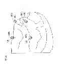 Fig. 31 - Denture system, engagement piece used for denture system, method for producing denture base and denture