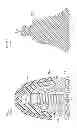 Fig. 32 - Denture system, engagement piece used for denture system, method for producing denture base and denture