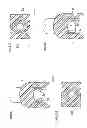 Fig. 34 - Denture system, engagement piece used for denture system, method for producing denture base and denture