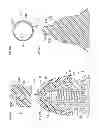 Fig. 35 - Denture system, engagement piece used for denture system, method for producing denture base and denture