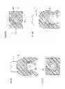 Fig. 41 - Denture system, engagement piece used for denture system, method for producing denture base and denture