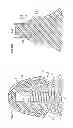 Fig. 43 - Denture system, engagement piece used for denture system, method for producing denture base and denture