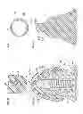 Fig. 45 - Denture system, engagement piece used for denture system, method for producing denture base and denture