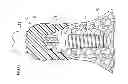 Fig. 48 - Denture system, engagement piece used for denture system, method for producing denture base and denture