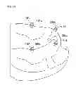 Fig. 50 - Denture system, engagement piece used for denture system, method for producing denture base and denture