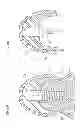 Fig. 53 - Denture system, engagement piece used for denture system, method for producing denture base and denture