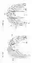 Fig. 56 - Denture system, engagement piece used for denture system, method for producing denture base and denture