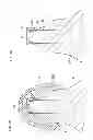 Fig. 57 - Denture system, engagement piece used for denture system, method for producing denture base and denture