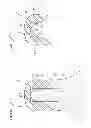 Fig. 58 - Denture system, engagement piece used for denture system, method for producing denture base and denture