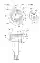 Fig. 62 - Denture system, engagement piece used for denture system, method for producing denture base and denture