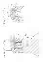 Fig. 65 - Denture system, engagement piece used for denture system, method for producing denture base and denture