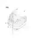 Fig. 02 - TOOTH MODEL USED FOR DENTAL TRAINING AND METHOD OF MANUFACTURING  SAME