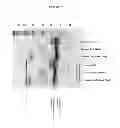 Fig. 08 - EXPRESSION OF CATALASE IN TRICHODERMA