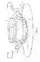 Fig. 07 - IN-VIVO BIOREACTOR SYSTEM AND METHOD FOR TISSUE ENGINEERING