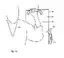 Fig. 06 - Martial arts training device