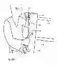 Fig. 07 - Martial arts training device