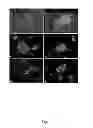 Fig. 02 - Devices and methods for detecting human metapneumovirus