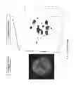 Fig. 22 - Methods For Characterizing And Isolating Circulating Tumor Cell Subpopulations