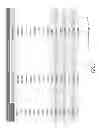 Fig. 06 - Methods for treating progeroid laminopathies using oligonucleotide analogues targeting human LMNA